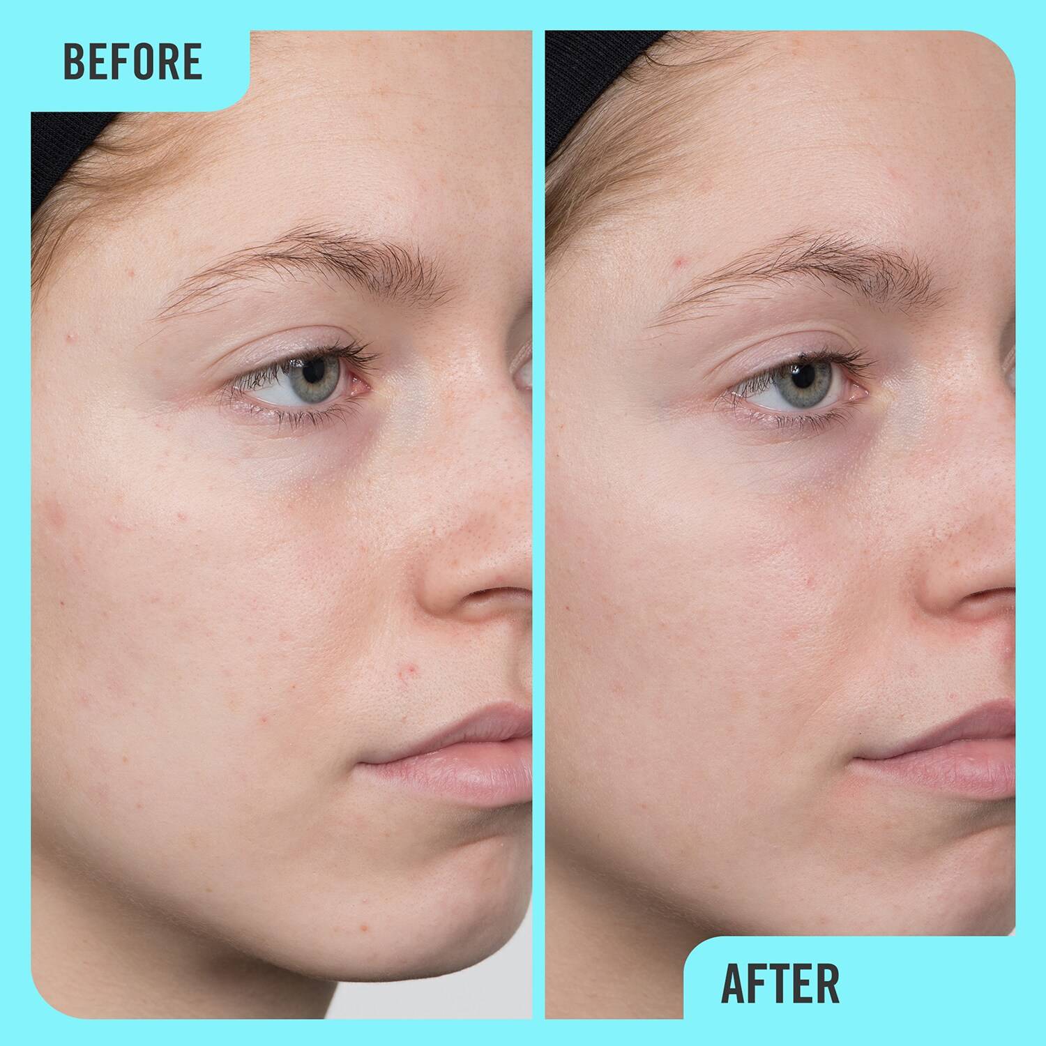 First Aid Beauty 10 Vitamin C Brightening Serum 30ml SEPHORA UK